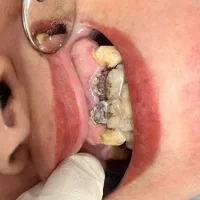 دندانپزشکی اطفال و بزرگسال|خدمات آرایشگری و زیبایی|رشت, پل تالشان|دیوار