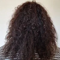 احیای موهای آسیب‌دیده