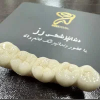 دندانپزشکی رز/ ایمپلنت/دندان مصنوعی/زیبایی
