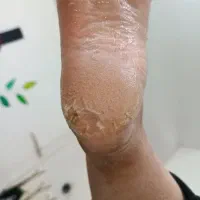 پدیکور