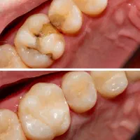 کامپوزیت و درمان،خدمات دندانپزشکی در محدوده