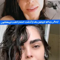 مرکز تخصصی ساکشن غبغب بوکال فت بلفارو کاشت ابرو|خدمات آرایشگری و زیبایی|تهران, پونک|دیوار
