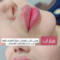 آموزش تزریق ژل بوتاکس و...