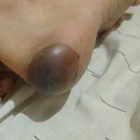 سونداژ سرم تراپی پانسمان زخم مامایی پرستاری منزل|خدمات آرایشگری و زیبایی|کرج, گوهردشت|دیوار