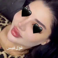 تخفیف تزریق فیلر و بوتاکس