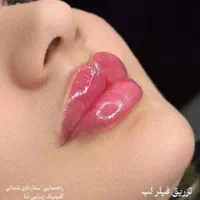 فیلرصورت بوتاکس کربن هایفو لیزرمو ریموتتو جوانسازی|خدمات آرایشگری و زیبایی|یاسوج, |دیوار