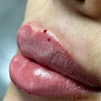 مدل ژل لب وبوتاکس فیلروغیره|خدمات آرایشگری و زیبایی|اسلام‌شهر, شهرک توحید|دیوار