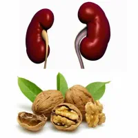 رفع سنگ کلیه