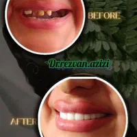 دندانپزشکی اقساطی باارائه وام و با کیفیتی استثنایی|خدمات آرایشگری و زیبایی|شیراز, ملاصدرا|دیوار