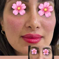 خدمات ژل بوتاکس آنزیم فیلر جوانساز مرو سر ابرو|خدمات آرایشگری و زیبایی|چهارباغ, |دیوار