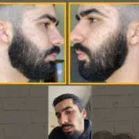 سرم رویش.تضمینی