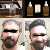 محلول سولوشن