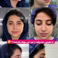 عمل،بینی
