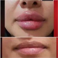 آموزش تحصصی ژل و بوتاکس و آنزیم|خدمات آموزشی|اسلام‌شهر, شهرک واوان|دیوار
