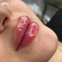فشیال پاکسازی پی آر پی هایفو لاغری کربن زگیل|خدمات زیبایی و سلامت|اصفهان, ملک‌شهر|دیوار