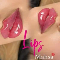 جشنواره پاییزه فیلر لب ژللب بوتاکس زاویه فک گونه|خدمات آرایشگری و زیبایی|کرج, مطهری|دیوار