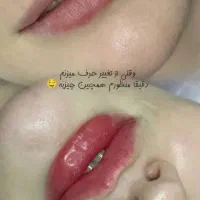 تزریقات ژل و بوتاکس و آنزیم|خدمات آرایشگری و زیبایی|اسلام‌شهر, شهرک مهدیه|دیوار