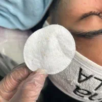 آموزش و خدمات پاکسازی پوست