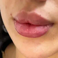 تخفیف ویژه در تمام لاینهای زیبایی|خدمات زیبایی و سلامت|تبریز, |دیوار