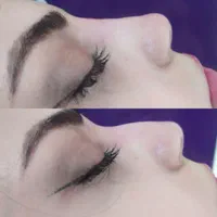 کلینیک ژل آنزیم بینی. لب بوتاکس فیلر و آموزش|خدمات آرایشگری و زیبایی|مشهد, آزادشهر|دیوار