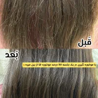 موخوره گیری