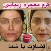 کرم سوپر معجزه صدرصد اصلی و ضمانتی|آرایشی، بهداشتی، درمانی|سنندج, |دیوار