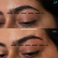 بمب تخفیف ژل ،بوتاکس،نخ وغیره فقط دوهفته لارم|خدمات آرایشگری و زیبایی|لار, |دیوار