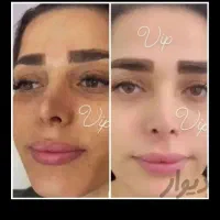 کرم سفید کننده و ضد لک ضد پیری رفع چروک جوش پوست|آرایشی، بهداشتی، درمانی|تهران, کامرانیه|دیوار