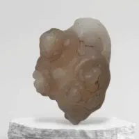 سنگ مهره