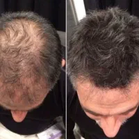 این اقدام آخریشه