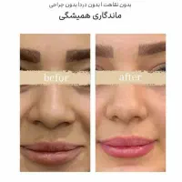 اتو|اتو و لوازم اتو|بندرعباس, |دیوار