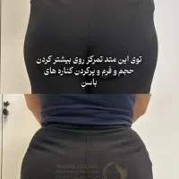 آف ۵۰٪ فیلر بادی هیپ دیپ سینه بیکینی باسن دست پا|خدمات آرایشگری و زیبایی|مشهد, نیروی هوایی|دیوار