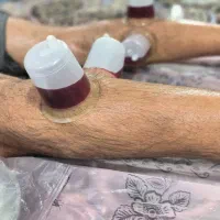 حجامت|خدمات آرایشگری و زیبایی|زاهدان, |دیوار