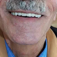 ساخت دندان مصنوعی|پزشکی|سنندج, |دیوار