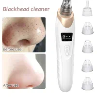 دستگاه میکرودرم خانگی|آرایشی، بهداشتی، درمانی|ایلام, |دیوار