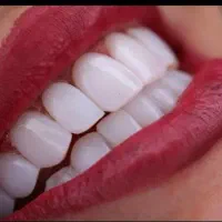 دندانسازی تخصصی دنیز|خدمات آرایشگری و زیبایی|زنجان, |دیوار