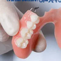 دندان گم شدهچند عدد دندان