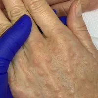 فیشال و پاکسازی تخصصی پوست، اف ۲۰درصد|خدمات آرایشگری و زیبایی|اندیمشک, |دیوار