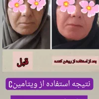 سرم نیاسینامید ضد لک وجوش|آرایشی، بهداشتی، درمانی|شیراز, باغ تخت|دیوار