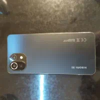 mi11lite 5g NE