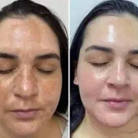 کرم ضدلک لاکچری کوین