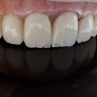 استخدام ادمین جهت پیج دندانپزشکی