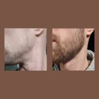 از ریش کم پشت تا ریش و مو ی فول آپشن