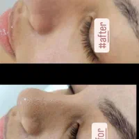 آموزش فیشال و پاکسازی تخصصی پوست مزونیدلینگ مزوایت|خدمات آرایشگری و زیبایی|مشهد, احمدآباد|دیوار