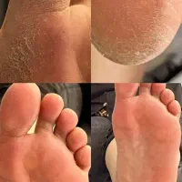 پدیکورتخصصی350آموزش پدیکور پاکسازی دست نوبهار|خدمات آرایشگری و زیبایی|کرمانشاه, |دیوار