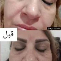 کرم معجزه  اصلی دستساز  متخصص تهران|آرایشی، بهداشتی، درمانی|کوهدشت, |دیوار