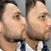 معجزه جذابیت