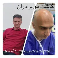 کاشت مو و ابرو در تبریز، پیش پرداخت ۶میلیون|خدمات آرایشگری و زیبایی|اردبیل, |دیوار