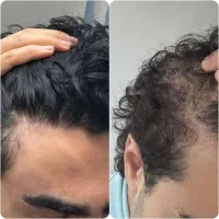 این اخرین روشیه که امتحان میکنی