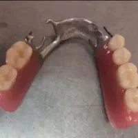 لابراتوار دندانسازی تخصصی(ساخت دندان مصنوعی)|حراج|اصفهان, کشاورزی|دیوار